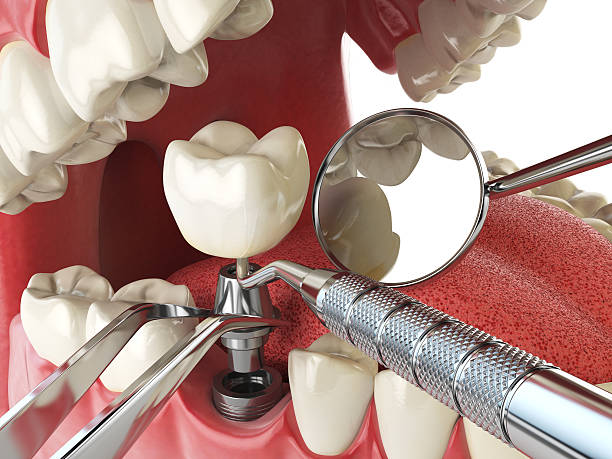 Best Emergency Dental Care for Trauma or Injury in Rusk, TX
